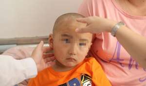 柞水4岁男童患癌 需6个治疗周期治疗费愁坏父母