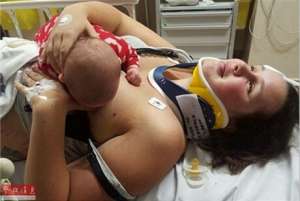 女子车祸重伤为给孩子喂奶拒用止痛药 忍痛4小时